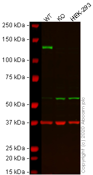 Western blot - Anti-Integrin alpha 6 antibody [EPR18124] - BSA and Azide free (AB240252), expandable thumbnail