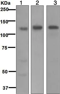 Western blot - Anti-Integrin alpha 6 antibody [EPR5578] (AB124924)