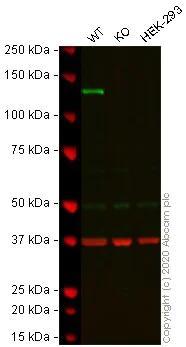 Western blot - Anti-Integrin alpha 6 antibody [EPR5578] (AB124924)