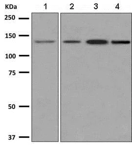 Western blot - Anti-Integrin alpha 9 antibody [EPR9722] (AB140599)