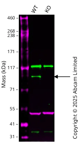 Western blot - Anti-Integrin alpha 9 antibody [EPR9722] (AB140599)