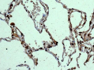Immunohistochemistry (Formalin/PFA-fixed paraffin-embedded sections) - Anti-Integrin alpha 9 antibody [EPR9722] - BSA and Azide free (AB240116)