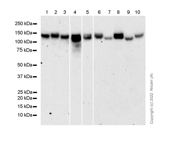 Western blot - Anti-Integrin alpha V antibody [21/CD51] - BSA and Azide free (AB302641)