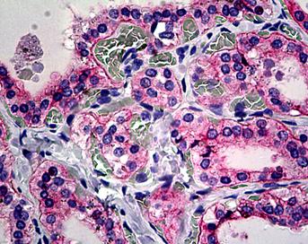 Immunohistochemistry (Formalin/PFA-fixed paraffin-embedded sections) - Anti-Integrin alpha V antibody (AB117611), expandable thumbnail