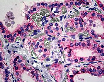Immunohistochemistry (Formalin/PFA-fixed paraffin-embedded sections) - Anti-Integrin alpha V antibody (AB117611)
