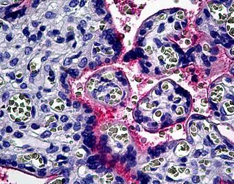 Immunohistochemistry (Formalin/PFA-fixed paraffin-embedded sections) - Anti-Integrin alpha V antibody (AB117611)
