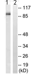 Western blot - Anti-Integrin alpha V antibody (AB117611)