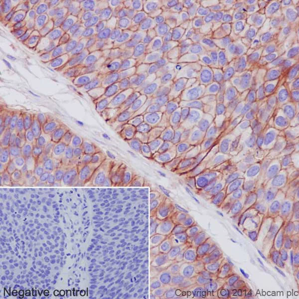 Immunohistochemistry (Formalin/PFA-fixed paraffin-embedded sections) - Anti-Integrin alpha V antibody [EPR16800] (AB179475)