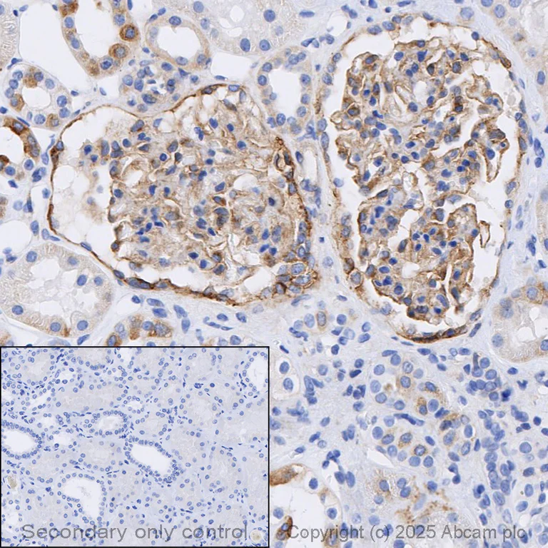 Immunohistochemistry (Formalin/PFA-fixed paraffin-embedded sections) - Anti-Integrin alpha V antibody [EPR16800] (AB179475)