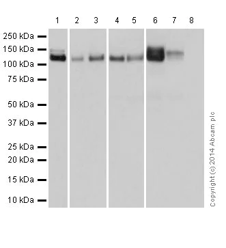 Western blot - Anti-Integrin alpha V antibody [EPR16800] (AB179475)