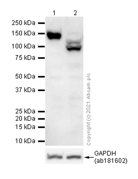 Western blot - Anti-Integrin alpha V antibody [EPR16800] (AB179475)
