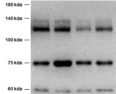 Western blot - Anti-Integrin alpha V antibody [EPR16800] (AB179475)