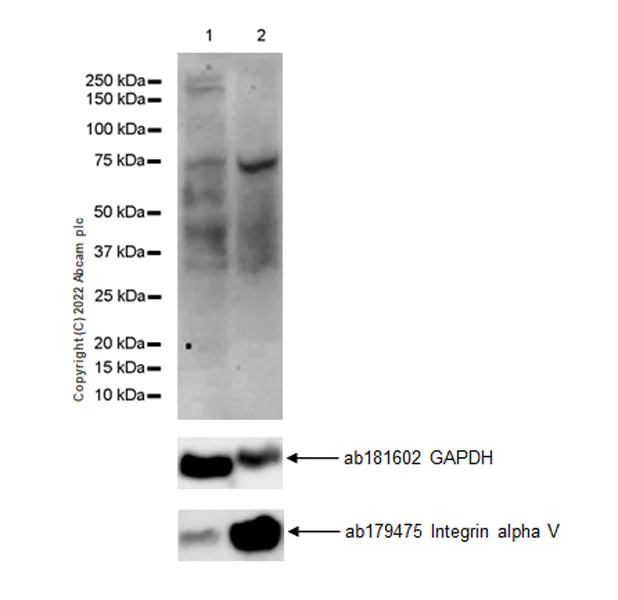 Western blot - Anti-Integrin alpha V antibody [EPR16800] (AB179475)