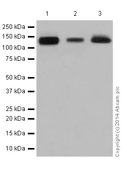 Western blot - Anti-Integrin alpha V antibody [EPR16800] (AB179475)