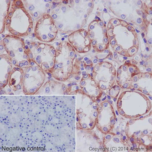 Immunohistochemistry (Formalin/PFA-fixed paraffin-embedded sections) - Anti-Integrin alpha V antibody [EPR16800] - BSA and Azide free (AB271932)