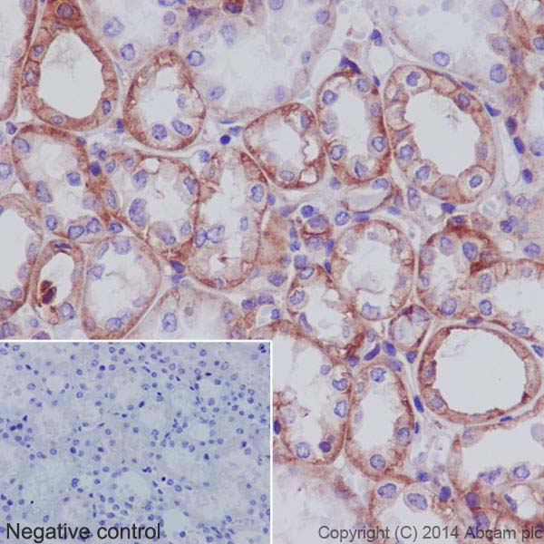 Immunohistochemistry (Formalin/PFA-fixed paraffin-embedded sections) - Anti-Integrin alpha V antibody [EPR16800] - Low endotoxin, Azide free (AB222222), expandable thumbnail