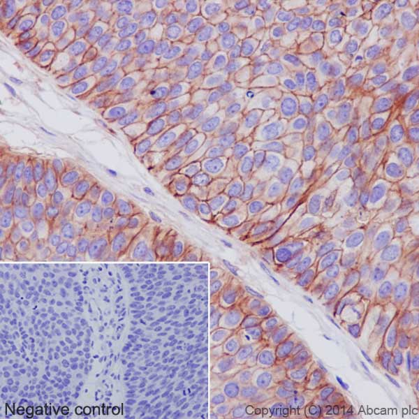 Immunohistochemistry (Formalin/PFA-fixed paraffin-embedded sections) - Anti-Integrin alpha V antibody [EPR16800] - Low endotoxin, Azide free (AB222222), expandable thumbnail