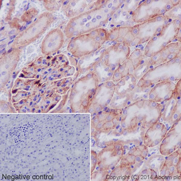 Immunohistochemistry (Formalin/PFA-fixed paraffin-embedded sections) - Anti-Integrin alpha V antibody [EPR16800] - Low endotoxin, Azide free (AB222222), expandable thumbnail