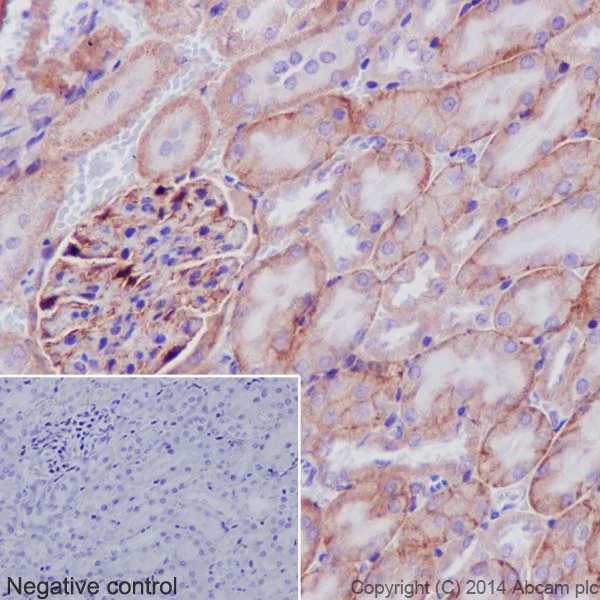 Immunohistochemistry (Formalin/PFA-fixed paraffin-embedded sections) - Anti-Integrin alpha V antibody [EPR16800] - Low endotoxin, Azide free (AB222222)