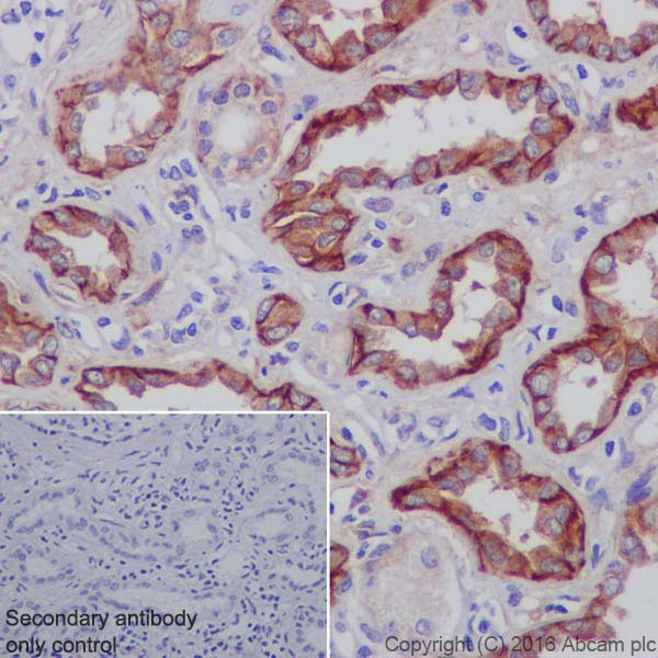 Immunohistochemistry (Formalin/PFA-fixed paraffin-embedded sections) - Anti-Integrin alpha V antibody [EPR19669] (AB208012), expandable thumbnail