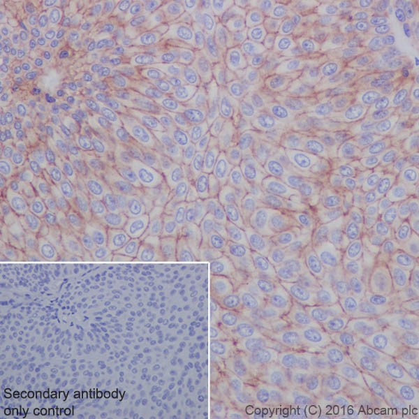 Immunohistochemistry (Formalin/PFA-fixed paraffin-embedded sections) - Anti-Integrin alpha V antibody [EPR19669] (AB208012), expandable thumbnail