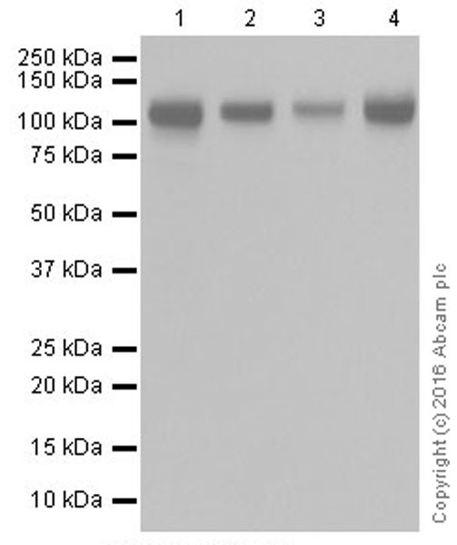 Western blot - Anti-Integrin alpha V antibody [EPR19669] (AB208012), expandable thumbnail