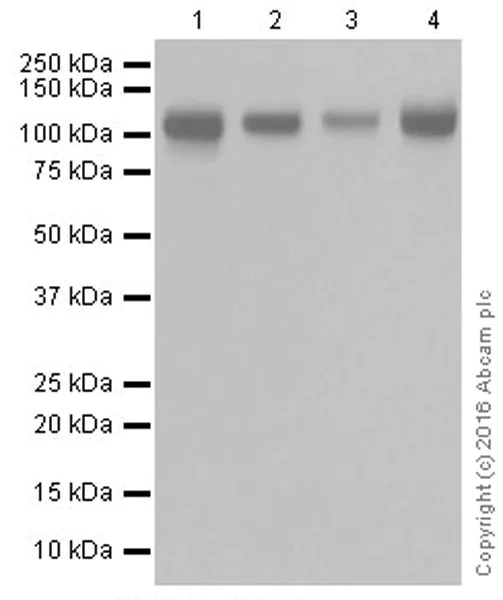 Western blot - Anti-Integrin alpha V antibody [EPR19669] (AB208012)