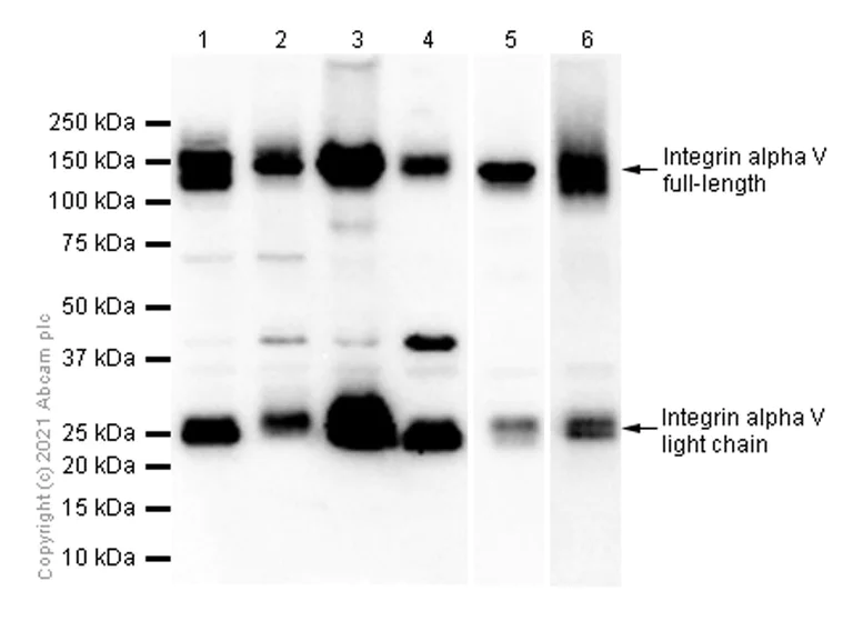 Western blot - Anti-Integrin alpha V antibody [EPR5583] (AB124968)