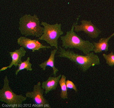 Immunocytochemistry/ Immunofluorescence - Anti-Integrin alpha V antibody [P2W7] (AB11470), expandable thumbnail