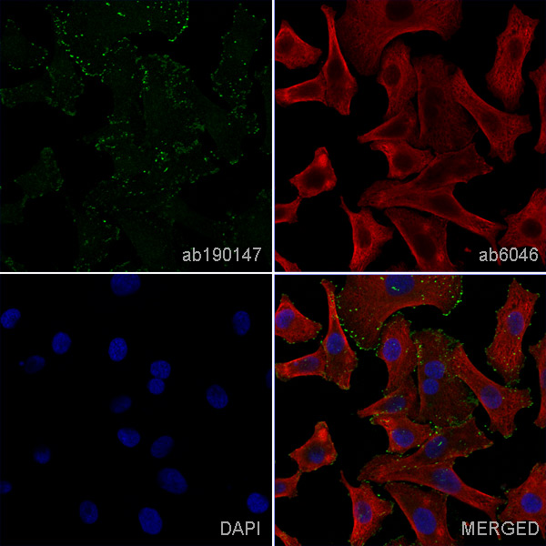 Immunocytochemistry - Anti-Integrin alpha V beta 3 antibody [LM609] - BSA and Azide free (AB238667), expandable thumbnail