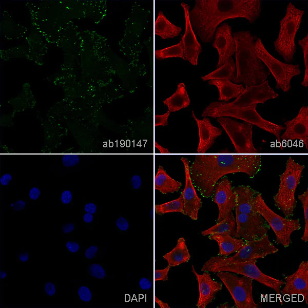 Immunocytochemistry - Anti-Integrin alpha V beta 3 antibody [LM609] - BSA and Azide free (AB238667)