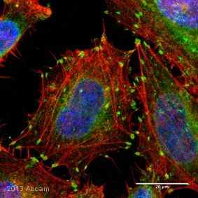 Immunocytochemistry/ Immunofluorescence - Anti-Integrin beta 1 antibody [12G10] (AB30394)