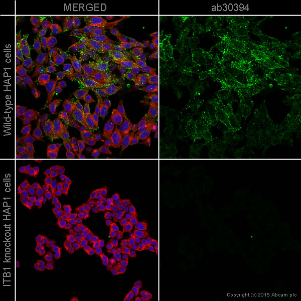 Immunocytochemistry/ Immunofluorescence - Anti-Integrin beta 1 antibody [12G10] - BSA and Azide free (AB230291), expandable thumbnail