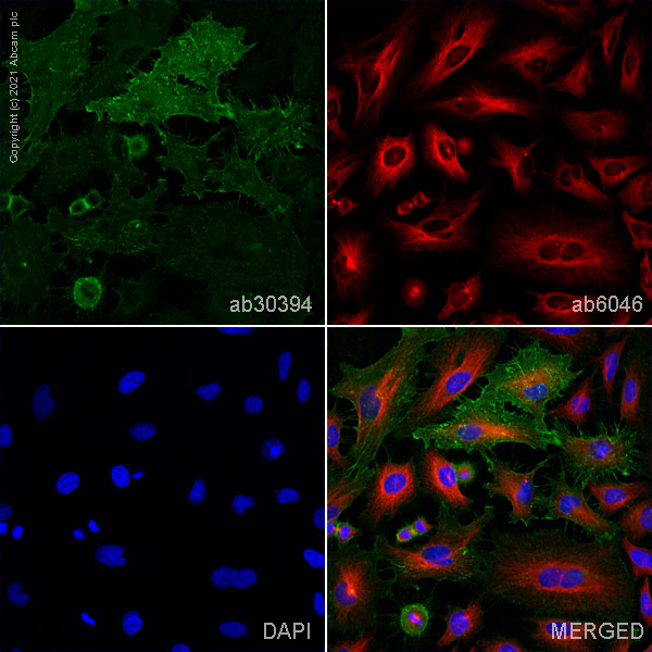 Immunocytochemistry/ Immunofluorescence - Anti-Integrin beta 1 antibody [12G10] - BSA and Azide free (AB230291), expandable thumbnail