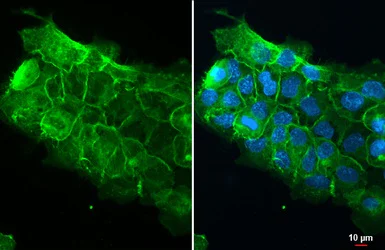 Immunocytochemistry/ Immunofluorescence - Anti-Integrin beta 1 antibody (AB183666)