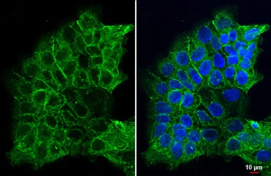 Immunocytochemistry/ Immunofluorescence - Anti-Integrin beta 1 antibody (AB183666)