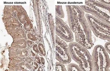 Immunohistochemistry (Formalin/PFA-fixed paraffin-embedded sections) - Anti-Integrin beta 1 antibody (AB183666)