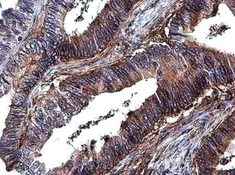 Immunohistochemistry (Formalin/PFA-fixed paraffin-embedded sections) - Anti-Integrin beta 1 antibody (AB183666)