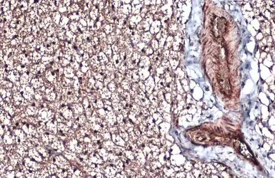 Immunohistochemistry (Formalin/PFA-fixed paraffin-embedded sections) - Anti-Integrin beta 1 antibody (AB183666)