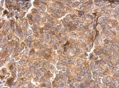 Immunohistochemistry (Formalin/PFA-fixed paraffin-embedded sections) - Anti-Integrin beta 1 antibody (AB183666)