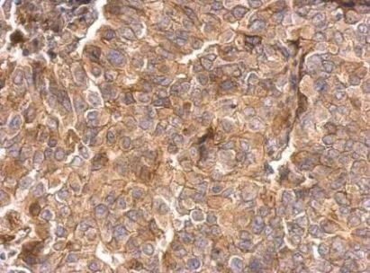 Immunohistochemistry (Formalin/PFA-fixed paraffin-embedded sections) - Anti-Integrin beta 1 antibody (AB183666)