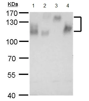Western blot - Anti-Integrin beta 1 antibody (AB183666)
