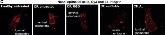 Immunohistochemistry - Anti-Integrin beta 1 antibody [EP1041Y] (AB52971)