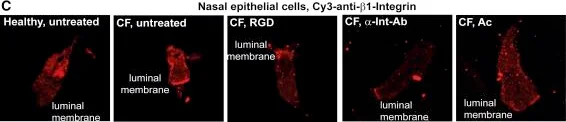 Immunohistochemistry - Anti-Integrin beta 1 antibody [EP1041Y] (AB52971)