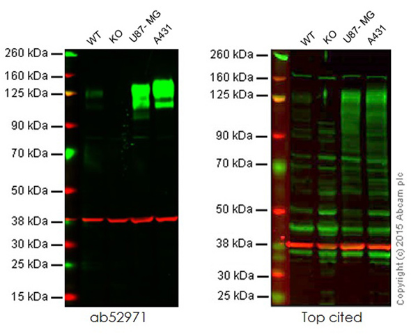 Western blot - Anti-Integrin beta 1 antibody [EP1041Y] (AB52971), expandable thumbnail