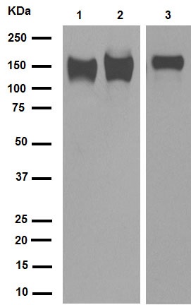 Western blot - Anti-Integrin beta 1 antibody [EP1041Y] (AB52971), expandable thumbnail