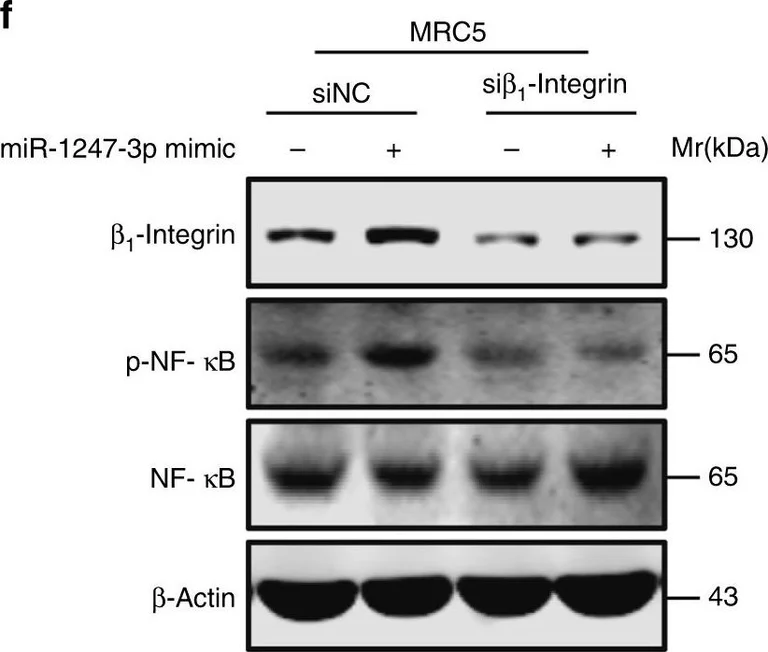 Western blot - Anti-Integrin beta 1 antibody [EP1041Y] (AB52971)