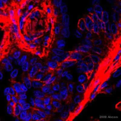 Immunohistochemistry (Formalin/PFA-fixed paraffin-embedded sections) - Anti-Integrin beta 1 antibody [EP1041Y] - BSA and Azide free (AB192456)
