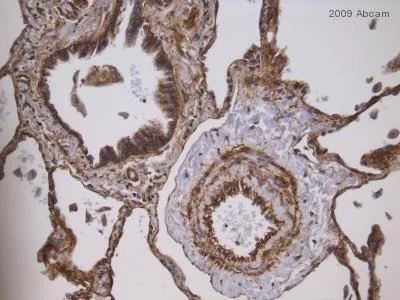 Immunohistochemistry (Formalin/PFA-fixed paraffin-embedded sections) - Anti-Integrin beta 1 antibody [EP1041Y] - BSA and Azide free (AB192456)