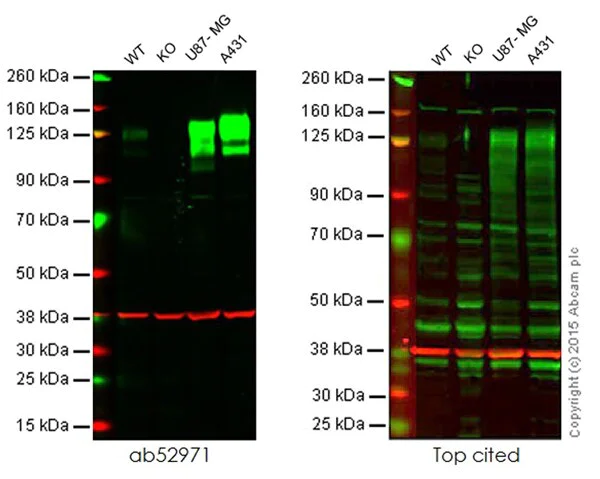 Western blot - Anti-Integrin beta 1 antibody [EP1041Y] - BSA and Azide free (AB192456)